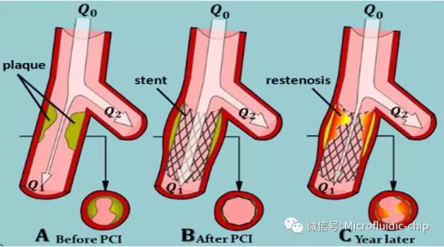 1488331743129164.jpg 33ccc79.jpg