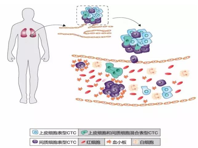 CTC循環腫瘤細胞的分類