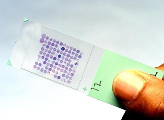 微陣列生物DNA芯片