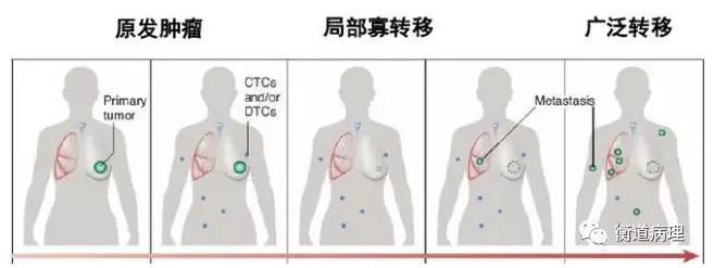 腫瘤輔助診斷