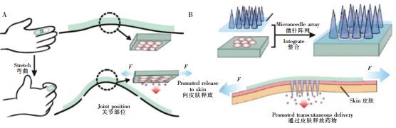 圖2可穿戴式微流控藥物釋放裝置。(A)內置藥物的可穿戴式微流控芯片,通過手指的彎曲完成藥物釋放(B)內置藥物的可穿戴芯片與微針陣列結合