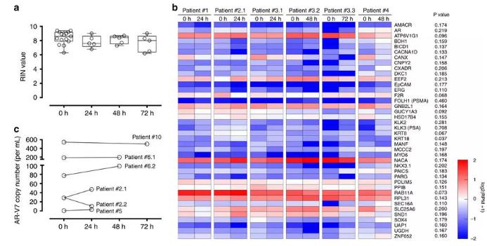 圖：從前列腺癌患者血液中分離出的CTC經(jīng)全血保存后含有完整的RNA，RNA測序和微滴數(shù)字PCR結(jié)果如圖所示。
