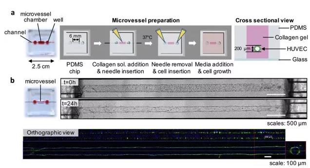 利用芯片制備體外人微血管。圖片來源：EBioMedicine