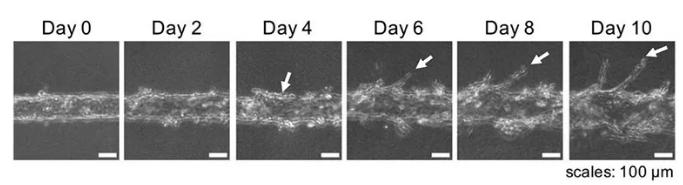 隨著時(shí)間的推移，可以用顯微鏡觀察到血管的新生。圖片來源：EBioMedicine