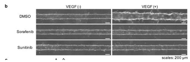 向芯片中添加抗腫瘤藥物sorafenib或sunitinib，觀察到了血管新生的抑制現(xiàn)象。 圖片來源：EBioMedicine