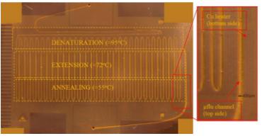 Microfluidic Continuous Flow/Flow-through system for 30 PCR cycles with the different heating zones pointed out