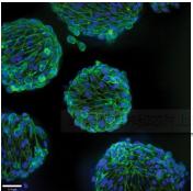 3D細胞培養微流控芯片 3D細胞培養微流控芯片