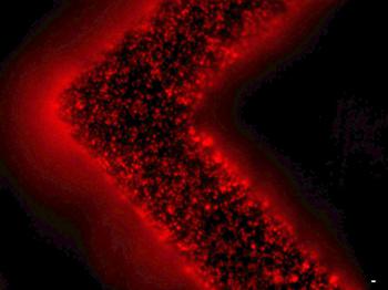 細胞外囊泡（紅色）從患者腫瘤細胞中釋放并被捕獲在EV-HB芯片表面。