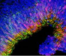 由3D細(xì)胞培養(yǎng)產(chǎn)生的新生視網(wǎng)膜 由3D細(xì)胞培養(yǎng)產(chǎn)生的新生視網(wǎng)膜