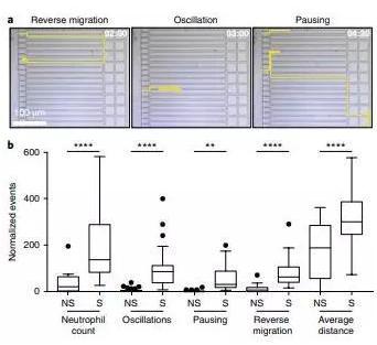 敗血癥特異性的中性粒細胞自發的遷移模式。
