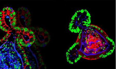 肝臟器官 肝臟器官