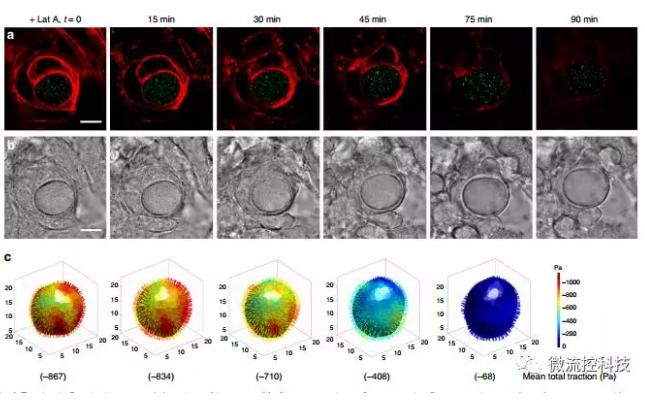 微流控技術(shù)開(kāi)發(fā)微型彈性球,可用于癌癥診斷 微流控技術(shù)開(kāi)發(fā)微型彈性球,可用于癌癥診斷