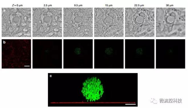 微流控技術(shù)開(kāi)發(fā)微型彈性球,可用于癌癥診斷 微流控技術(shù)開(kāi)發(fā)微型彈性球,可用于癌癥診斷