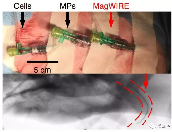 實(shí)際裝置和造影下的磁線