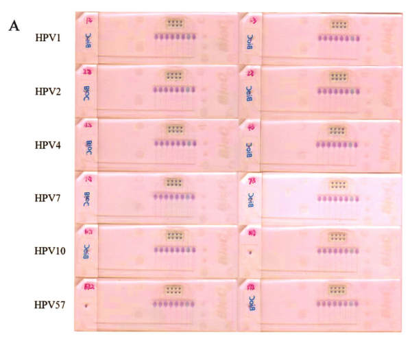 圖5皮膚低危型別中3小組組問特異性檢測
