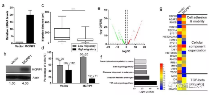 圖 3 MCPIP1抑制單細(xì)胞遷移并且抑制TGF-beta通路